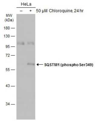 Western Blot: p62/SQSTM1 [p Ser349] Antibody [NBP3-13329]